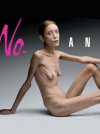 Итальянский бренд против анорексии: шокирующая рекламная кампания